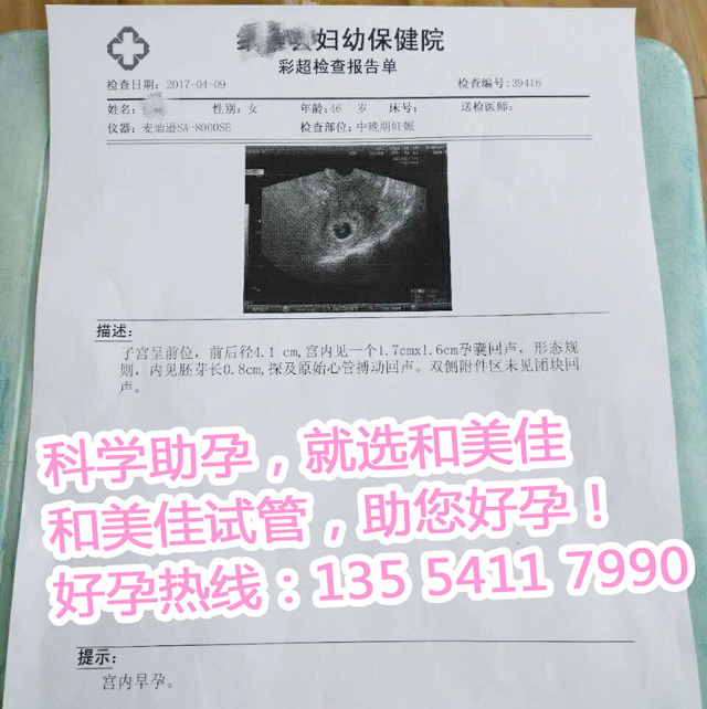 基因筛查染色体问题,第三代试管婴儿技术展现非凡实力